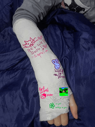 allyson's arm cast with my signature added: "best wishes! aster"